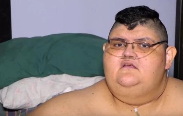 Θα πάθετε σοκ! Αυτός είναι ο πιο παχύς άνθρωπος στον κόσμο – Πόσο ζυγίζει